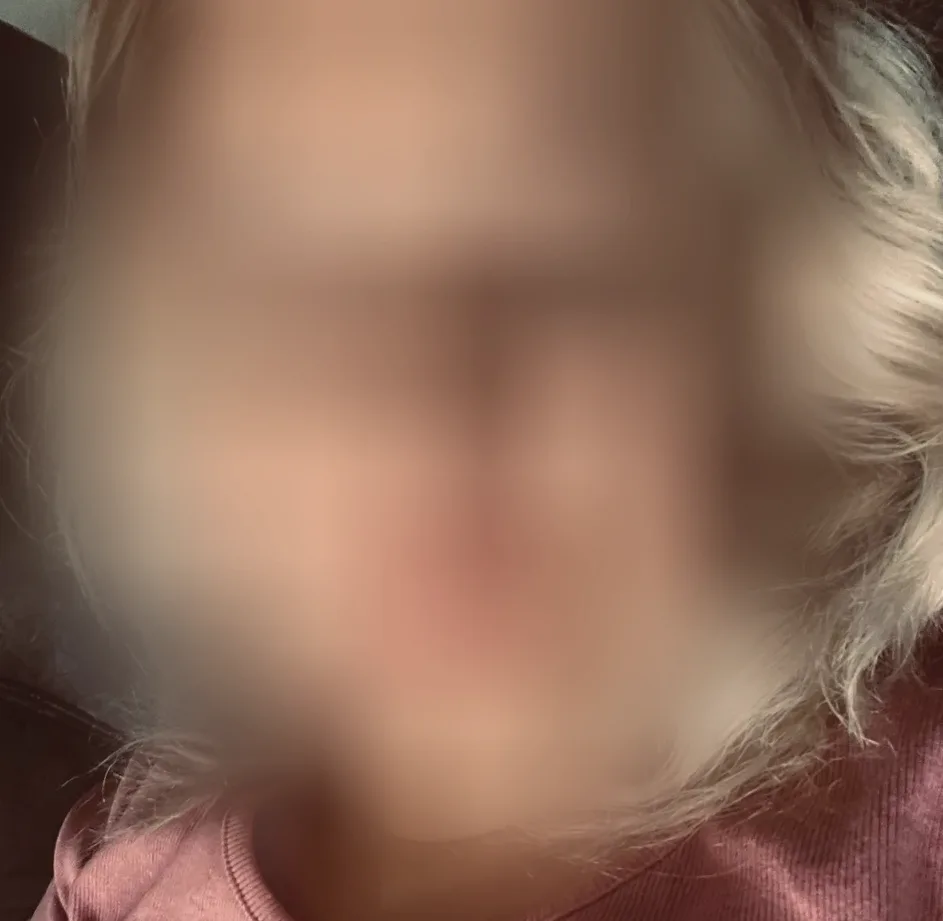 Skye, 29